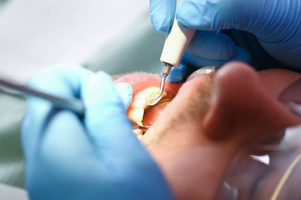 Best Broken Tooth Emergency  in Belmond, IA